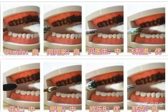 电动牙刷选购技巧_电动自行车行业现状_电动牙刷避雷指南