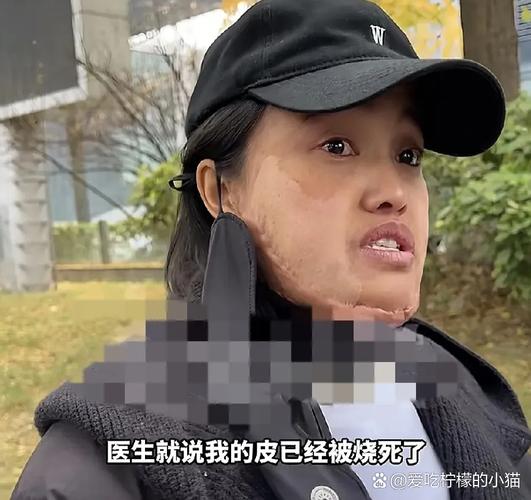 感情破裂离婚的例子：成都母亲摔死幼儿，北京媳妇烧伤孩子背后真相